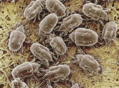 光曬棉被是殺不光螨蟲的，教你一個輕松的方法殺滅它